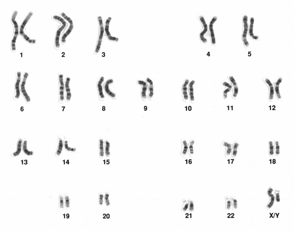 An example set of chromosomes from a male human